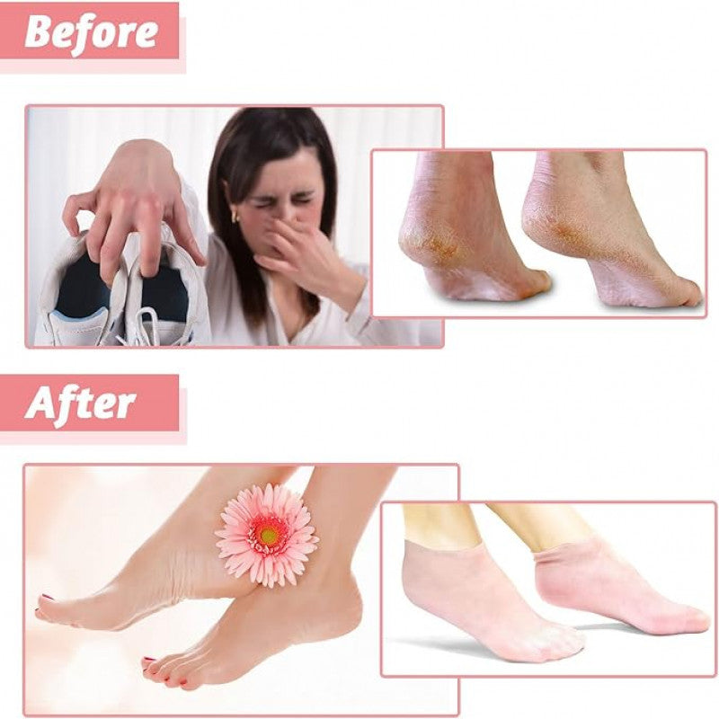 Moisturizing Silicone Socks For Dry Cracked Heels